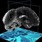 Создан самый большой и подробный путеводитель по человеческому мозгу