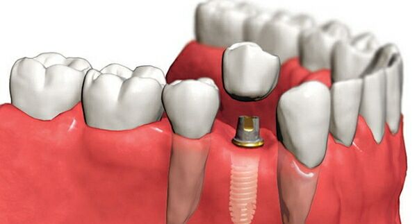 Инновации в стоматологии