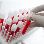 Анализ ПСА общий Анализ ПСА общий